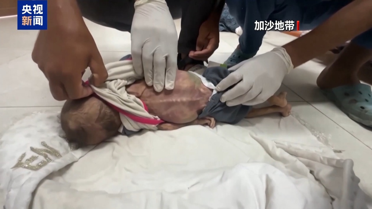 联合国儿基会：加沙新生儿面临严重营养不良危机